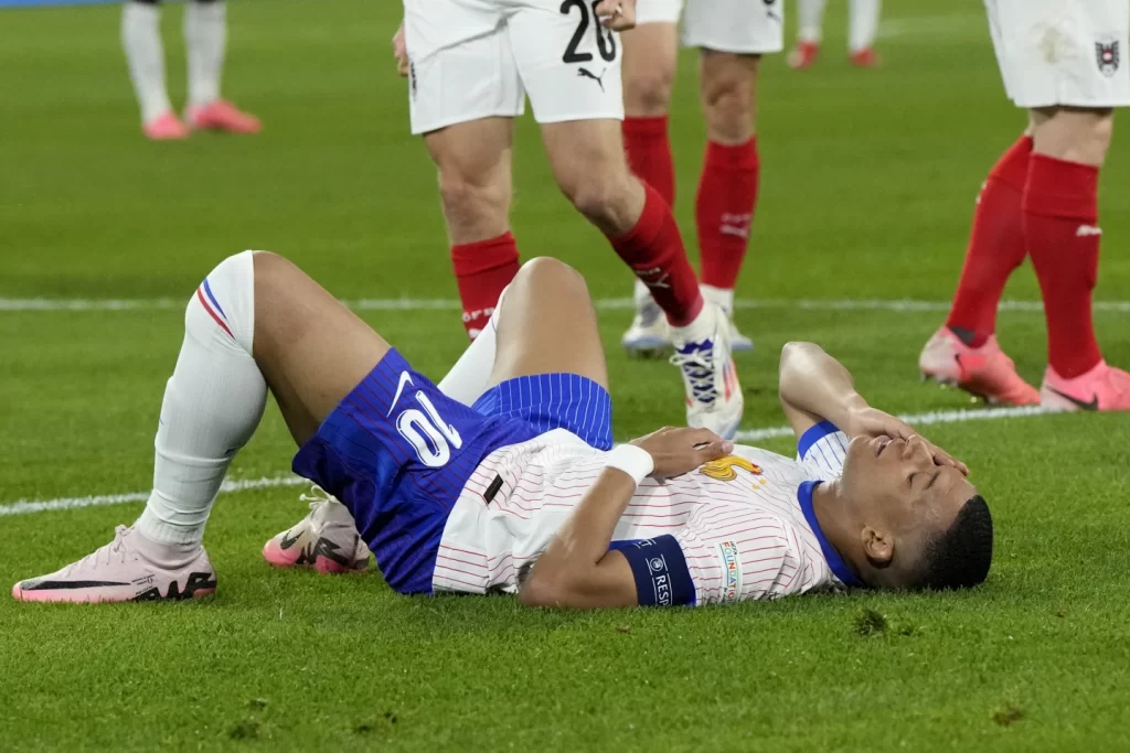 France's Kylian Mbappé Suffers Broken Nose in Euro Win Over Austria - Socceronlinew